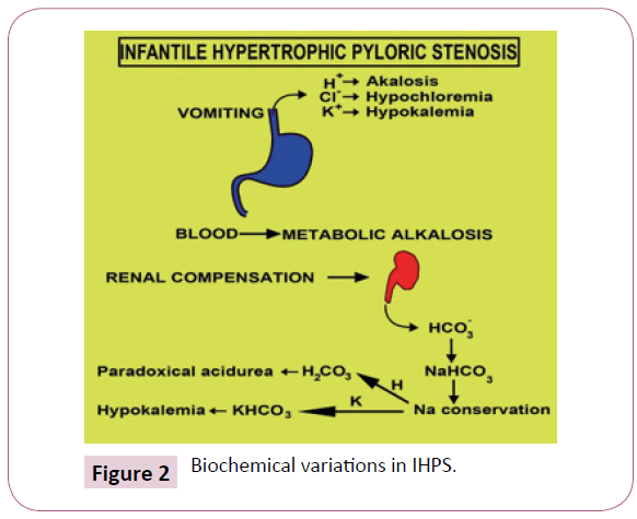 Pathophysiology Of Pyloric Stenosis In Flow Chart