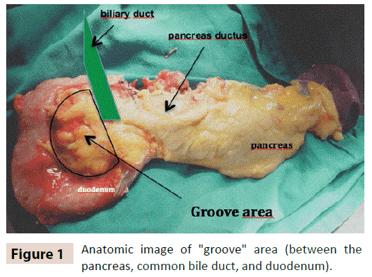 digestive-diseases-Anatomic-image