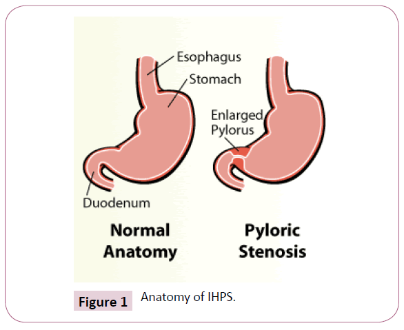 digestive-diseases-Anatomy-IHPS