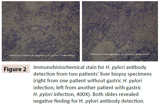 digestive-diseases-Immunohistochemical-stain